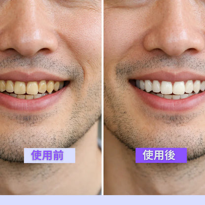 Usonic™ TikTok・Instagramで話題｜販売数No.1